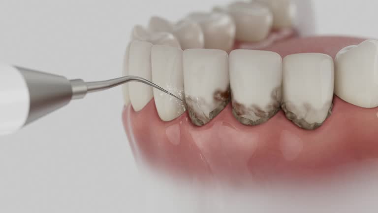 Reliable Dental contractor in Cleveland County County, NC by Dentist Open Now
